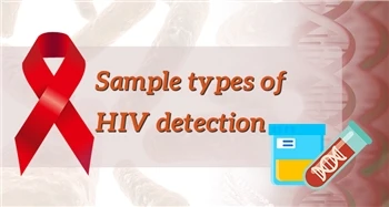انواع نمونه تشخیص HIV